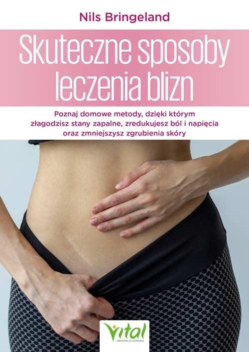 Skuteczne sposoby leczenia blizn, Nils Bringeland