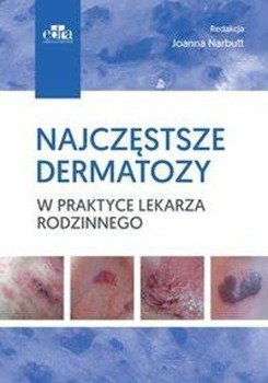 Najczęstsze dermatozy w praktyce lekarza rodzinnego - Narbutt J.