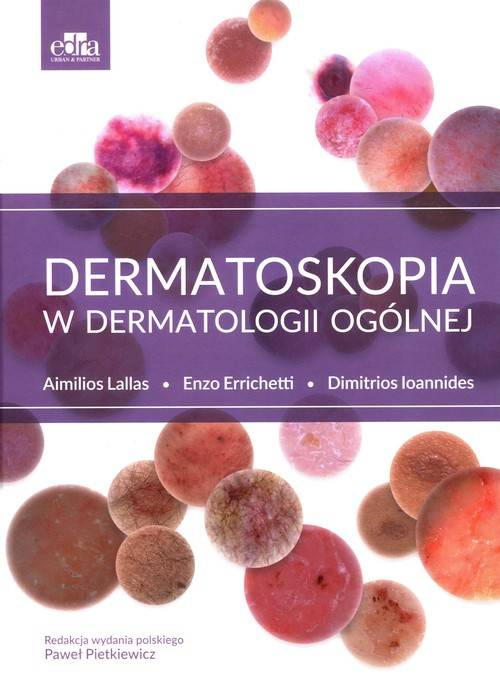 Dermatoskopia w dermatologii ogólnej, Lallas A.