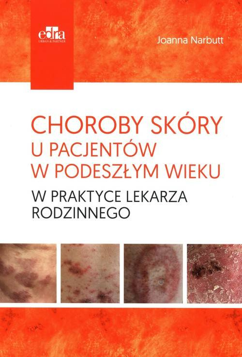 Choroby skóry u pacjentów w podeszłym wieku w praktyce lekarza rodzinnego, Narbutt J.