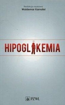 Hipoglikemia - Karnafel Waldemar