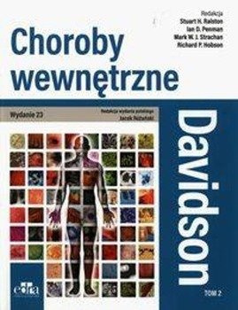 Davidson Choroby wewnętrzne Tom 2 - Stuart H. Ralston, Mark W.J. Strachan, Ian D. Penman, Richard P. Hobson